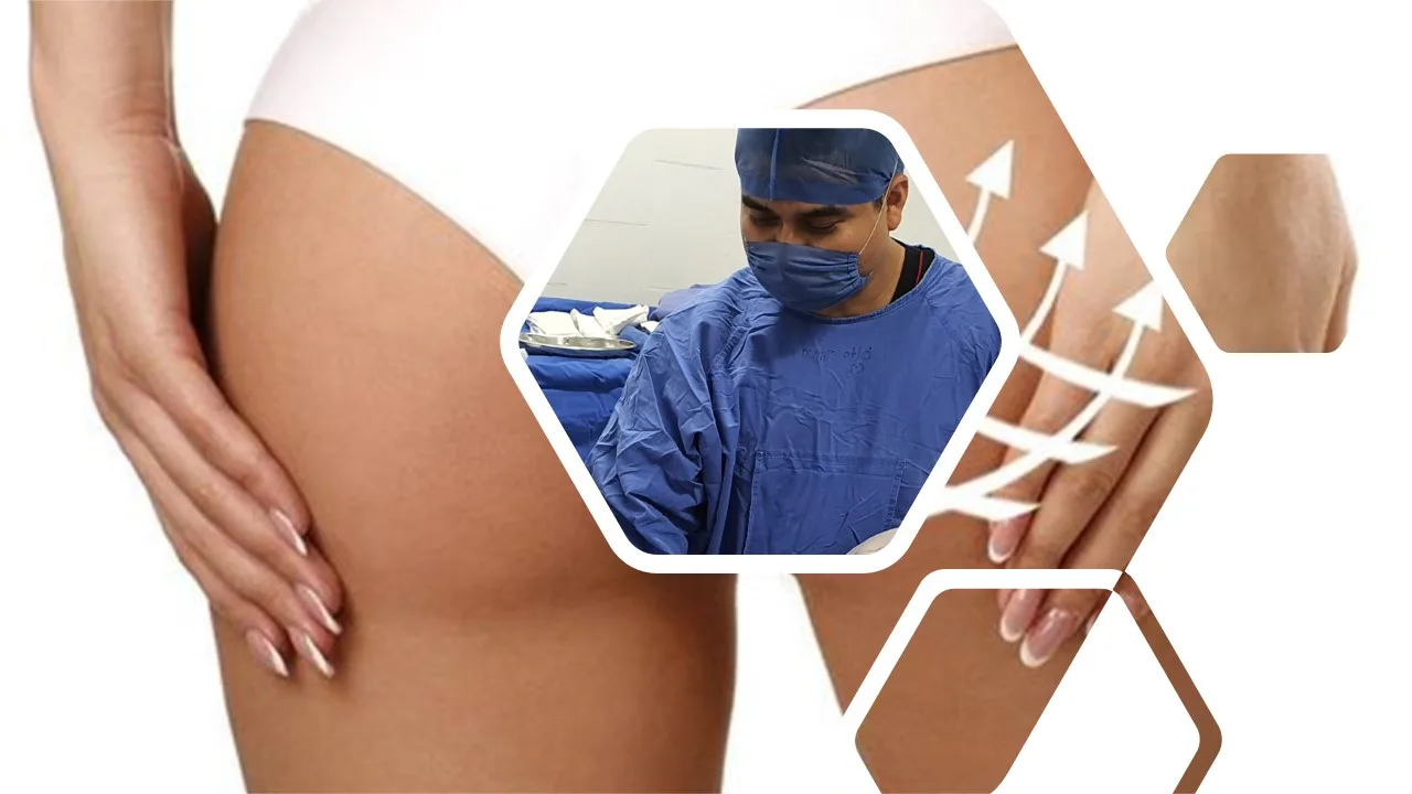 aumento-de-gluteo