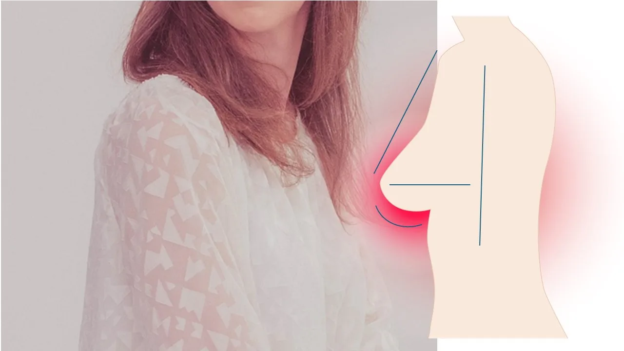 mamoplastia-de-aumento