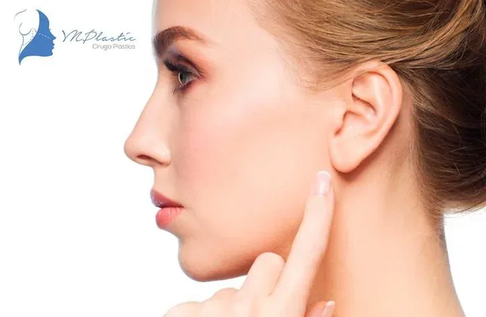 Otoplastía